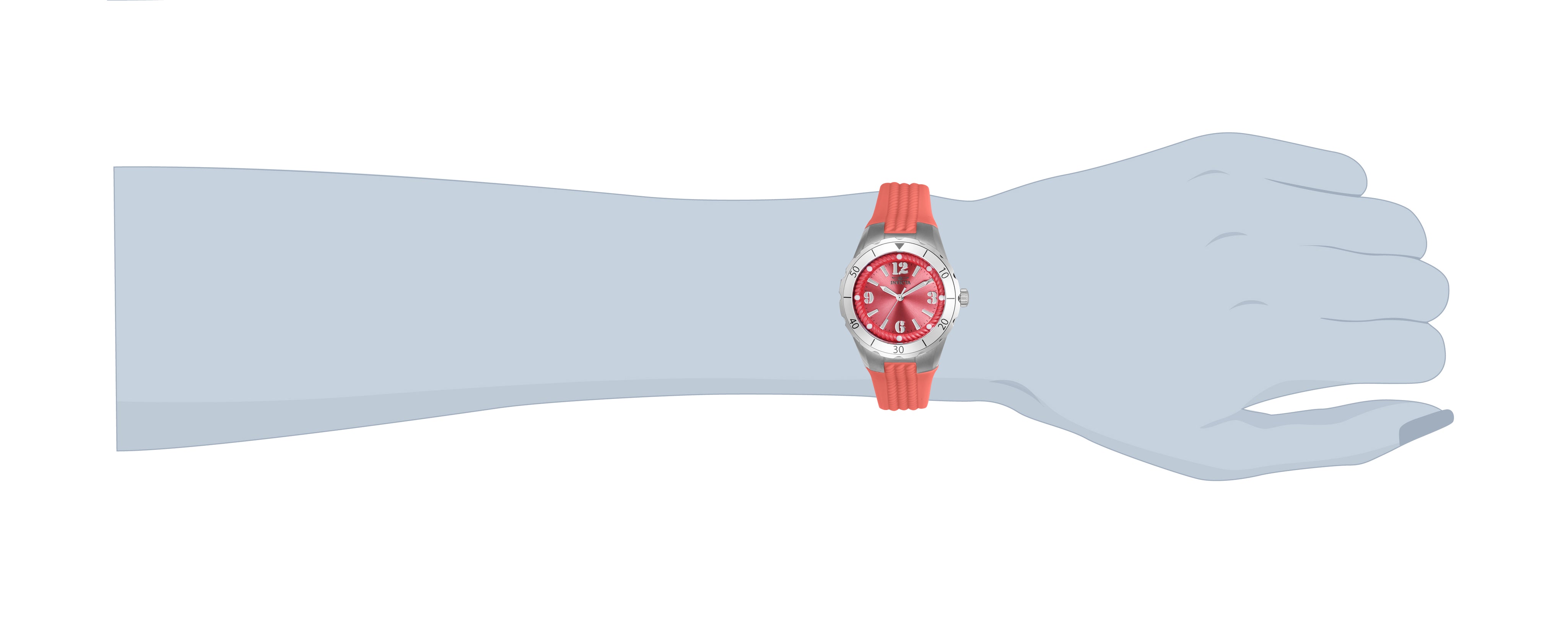169375_24122-wrist.jpg