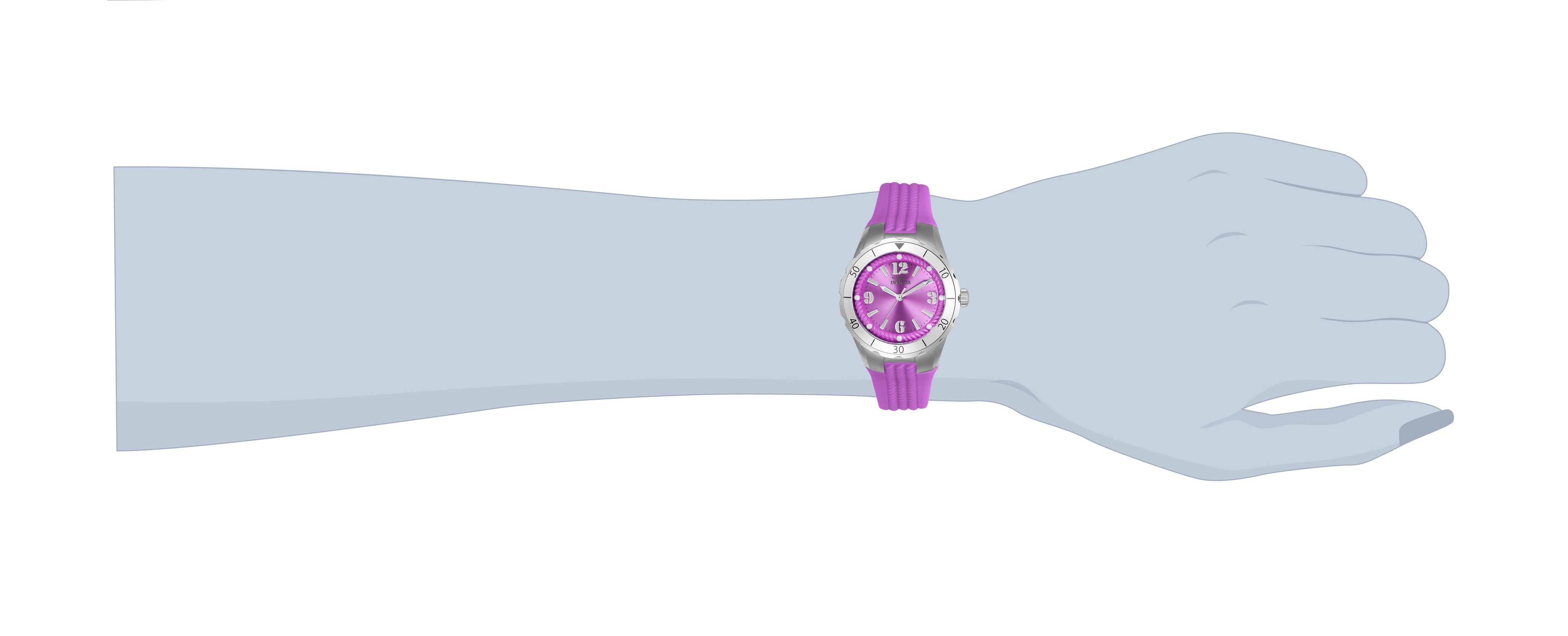 169376_24123-wrist.jpg