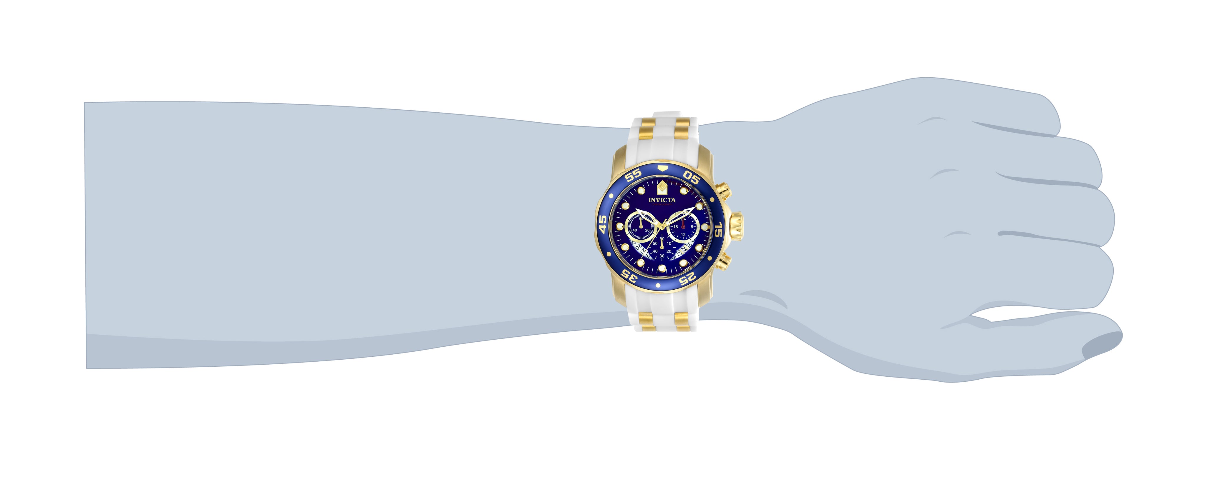 174376_20288-wrist.jpg