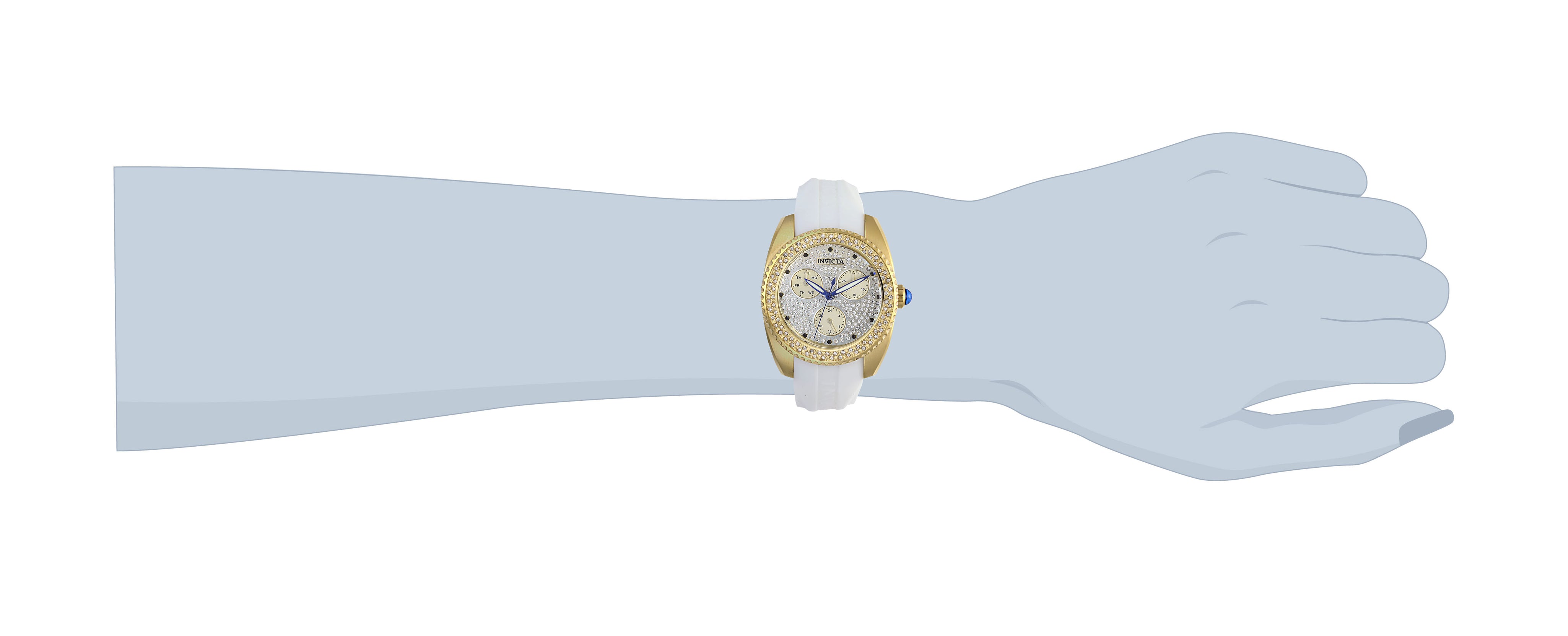 236075_28484-wrist.jpg