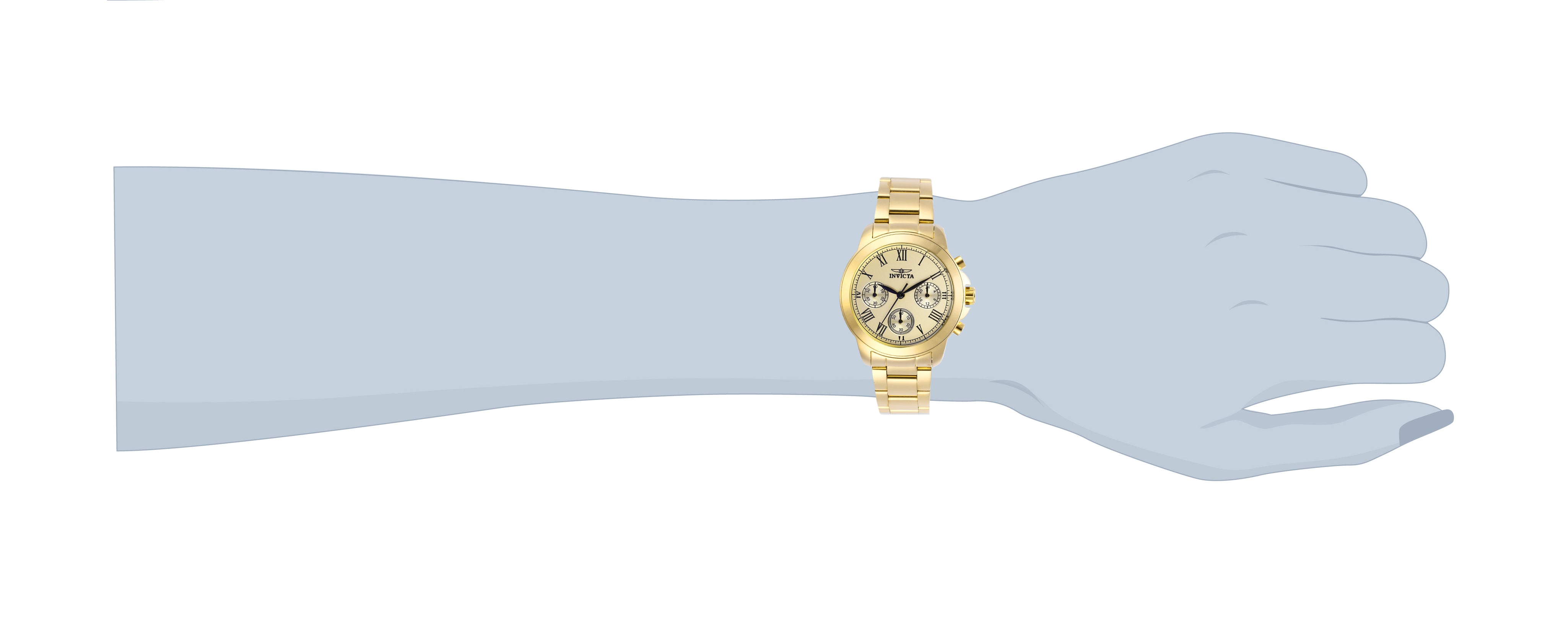 252393_21654-wrist.jpg